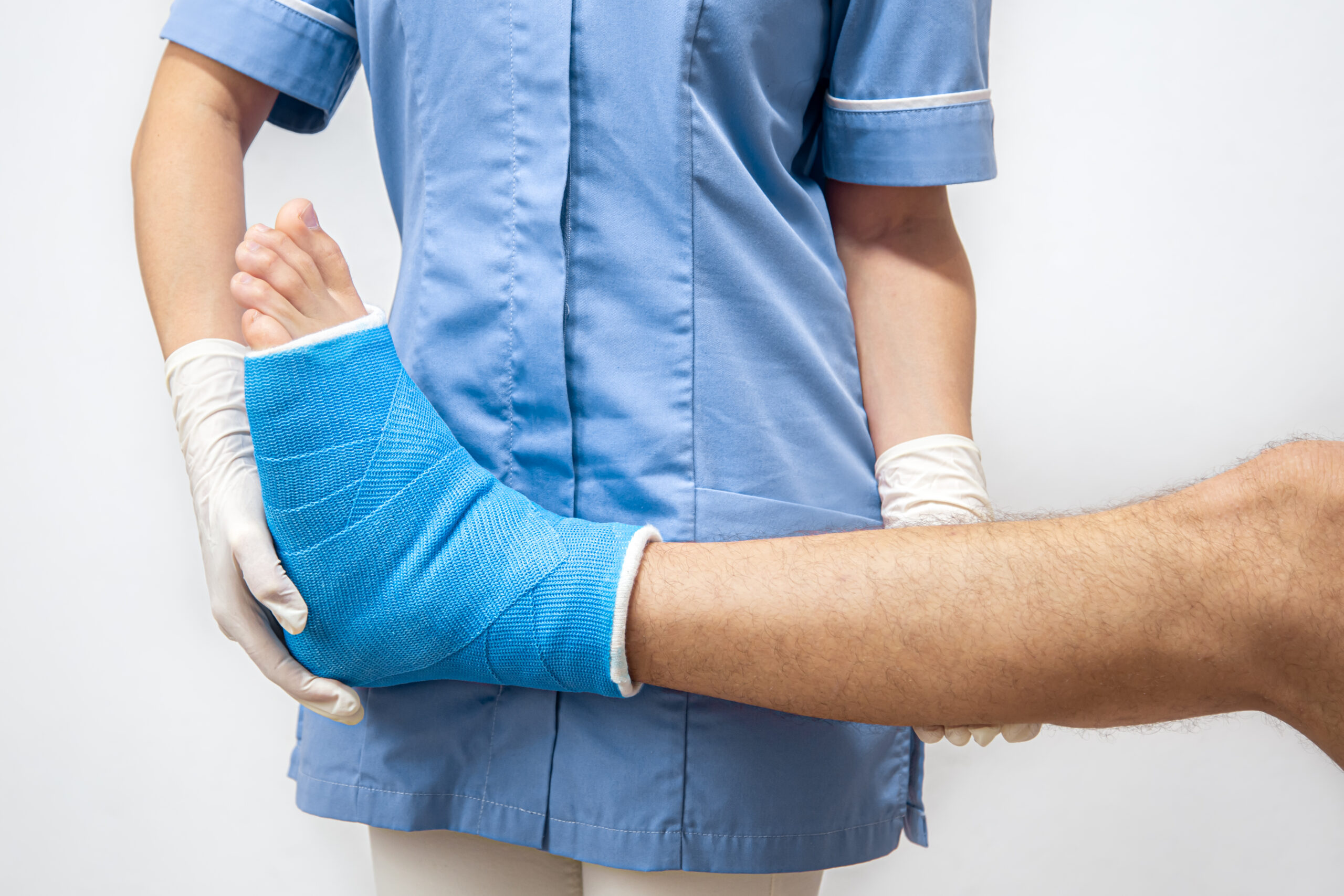 Close up of a man's leg in a cast and a blue splint after bandaging in a hospital.
